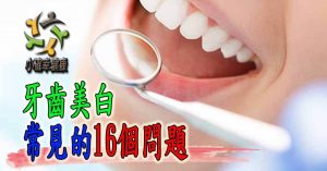 牙齒美白常見的16個問題