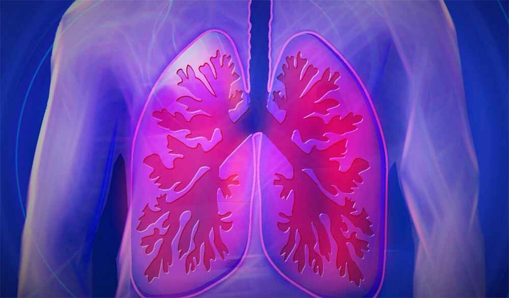 肺癌13種飲食介紹，改善症狀提升存活率